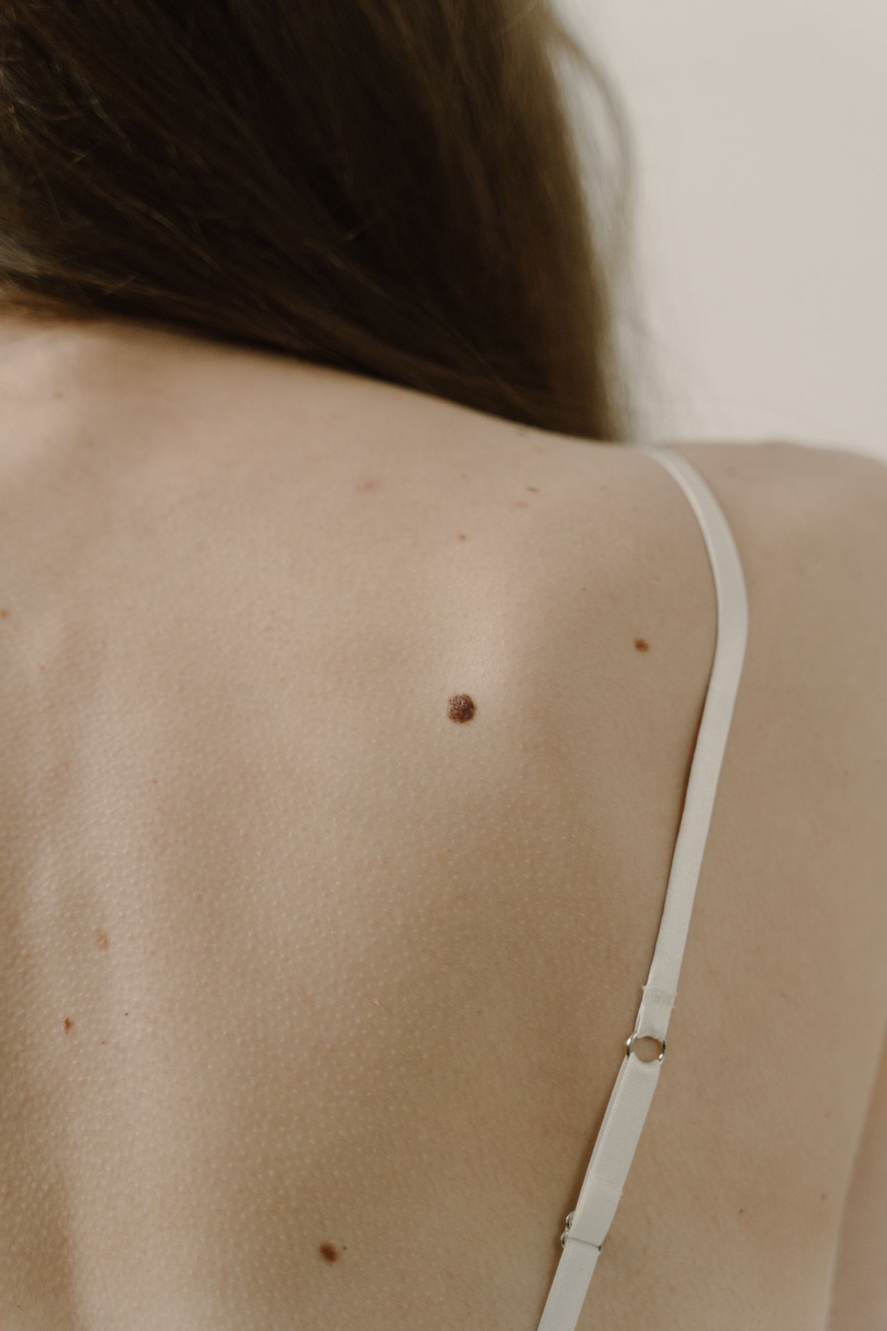 Gros plan de peau avec un grain de beauté