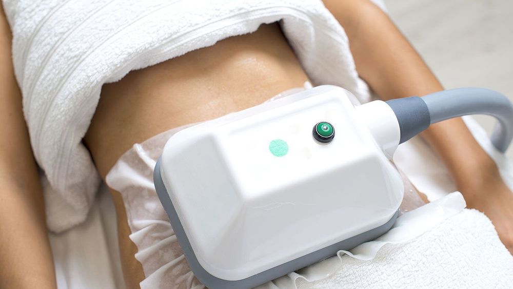 Cryolipolyse, cabinet du Dr Christophe Klein, Génissac